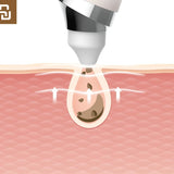 Beauty Plus Vacuum Pore Cleaner