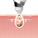 Beauty Plus Vacuum Pore Cleaner